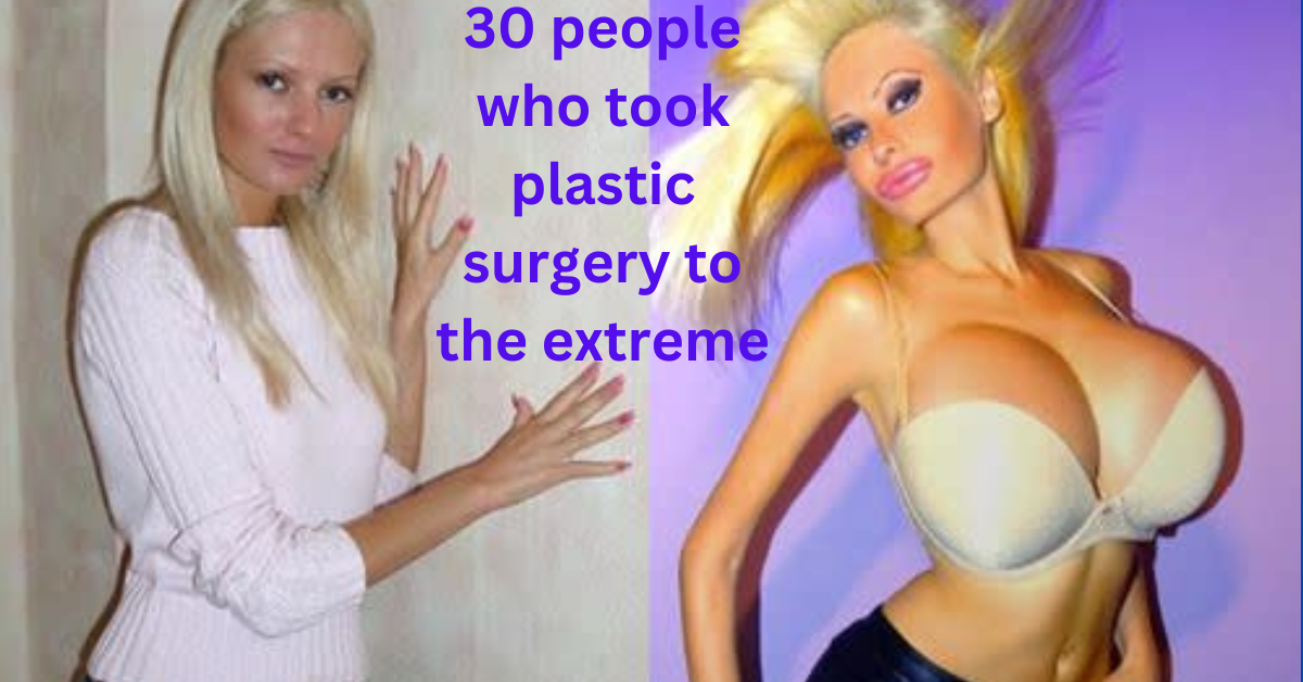 people who took plastic surgery to the extreme